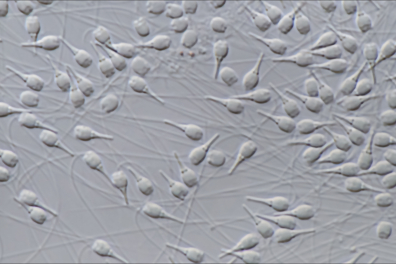 Spermatozoïdes de la Moule (Mytilus edulis) x400